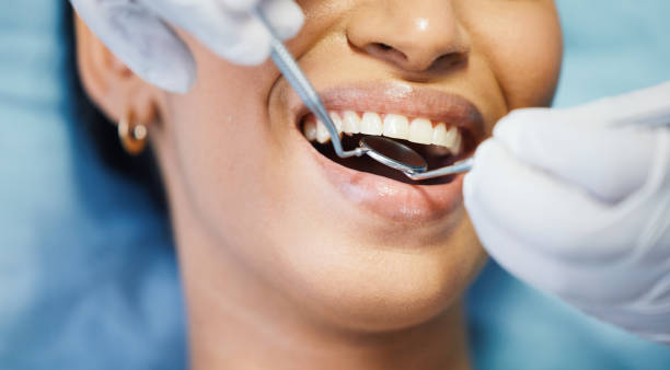 Best Emergency Cosmetic Dentistry (e.g., broken veneers) in Shorewood Forest, IN